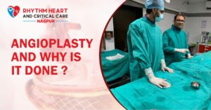 Rhythm Hospital - Angioplasty and Why is It Done?