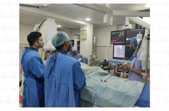 Best Angiography In Nagpur