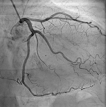 Best Angiogram Hospital In Nagpur