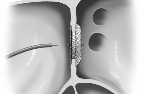 Device Closure Procedure