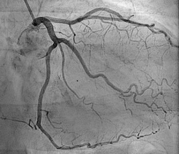 Pediatric Opthalmology and Squint