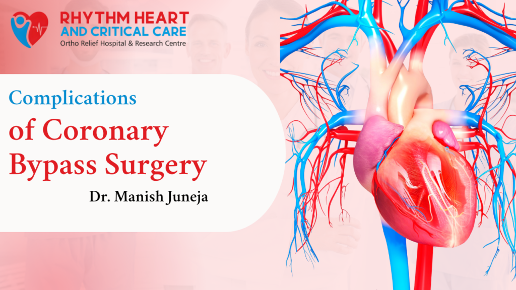 Coronary Bypass Surgery