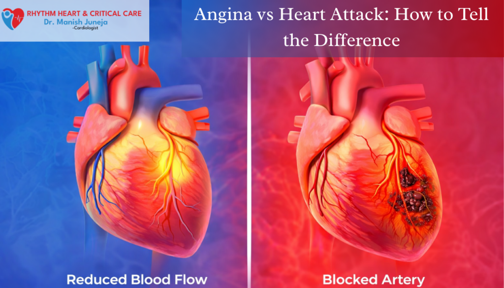 Angina vs Heart Attack: How to Tell the Difference