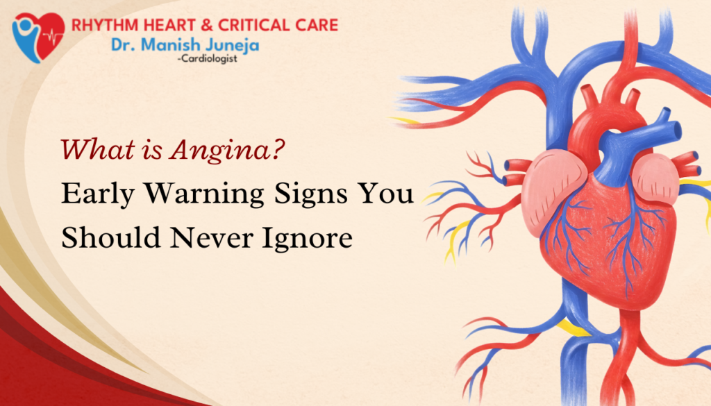What Is Angina? Early Warning Signs You Should Never Ignore