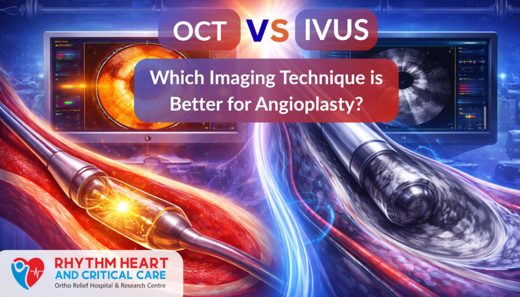 OCT vs IVUS: Which Imaging Technique is Better for Angioplasty?