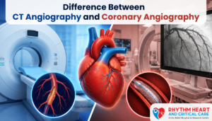 Difference Between Coronary Angiography and CT Angiography