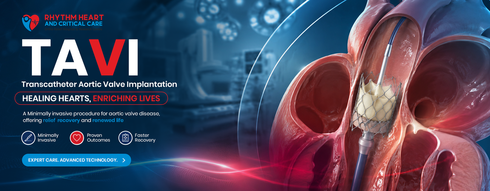 TAVI procedure in nagpur
