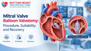 Mitral Valve Balloon Valvotomy: Procedure, Suitability and Recovery